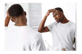 man-checks-hair-line-in-mirror-for-hair-loss